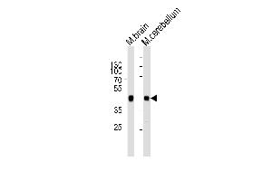 Western blot analysis of lysates from mouse brain and mouse cerebellum tissue lysate (from left to right), using ZDHHC14 Antibody (Center) (ABIN6243381 and ABIN6577546). (ZDHHC14 antibody  (AA 283-317))