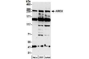 anti-AT Rich Interactive Domain 2 (ARID, RFX-Like) (ARID2) (AA 1600-1650) antibody