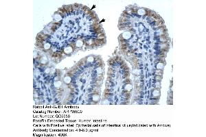 Human Intestine (GJB1 antibody  (C-Term))