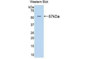 Detection of Recombinant ALT, Rat using Polyclonal Antibody to Alanine Aminotransferase (ALT) (ALT antibody  (AA 1-496))