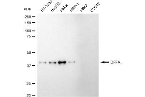 Western blotting analysis using DFFA antibody (ABIN7798364).