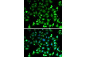 Immunofluorescence analysis of MCF-7 cells using RAE1 antibody (ABIN5974056). (RAE1 antibody)