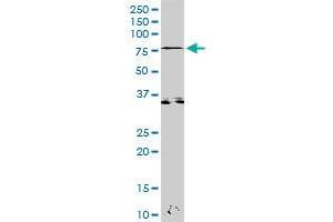 ZAP70 MaxPab rabbit polyclonal antibody. (ZAP70 antibody  (AA 1-619))