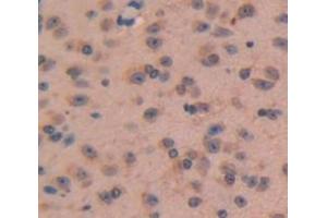 Figure. (NPPC antibody  (AA 18-104))