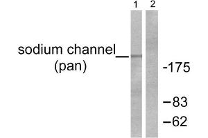 Western blot analysis of extracts from HuvEc cells, using Sodium Channel-pan Antibody (ABIN5976507).