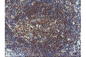 Image no. 1 for anti-Prefoldin Subunit 3 (PFDN3) antibody (ABIN1501704) (VBP1 antibody)