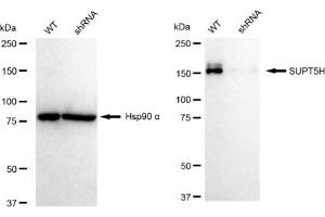 Western blotting analysis using SUPT5H antibody (ABIN7800586).