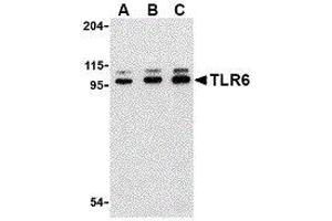 Western Blotting (WB) image for anti-Toll-Like Receptor 6 (TLR6) (Center) antibody (ABIN2479759) (TLR6 antibody  (Center))