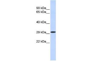 Western Blotting (WB) image for anti-Kruppel-Like Factor 14 (KLF14) antibody (ABIN2458210)