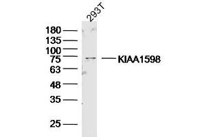293T lysates probed with KIAA1598 Polyclonal Antibody, Unconjugated  at 1:300 dilution and 4˚C overnight incubation. (Shootin-1 (SHTN1) (AA 21-130) antibody)