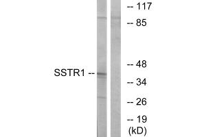 Western blot analysis of extracts from COS-7 cells, using SSTR1 antibody. (SSTR1 antibody  (N-Term))