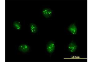 Immunofluorescence of purified MaxPab antibody to PDE9A on HeLa cell.