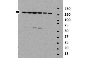 Researcher: Daolin Tang, University of Pittsburgh Medical Center Species+tissue/cell type: Lane 1-6: 30ug mouse MEF lysate Primary antibody dilution: 1:2000 (TNKS antibody  (Middle Region))