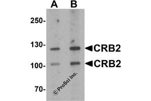 Western Blotting (WB) image for anti-Crumbs Homolog 2 (CRB2) antibody (ABIN1077416) (CRB2 antibody)
