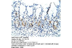 Rabbit Anti-ADAT1 Antibody  Paraffin Embedded Tissue: Human Stomach Cellular Data: Epithelial cells of fundic gland Antibody Concentration: 4. (ADAT1 antibody  (C-Term))