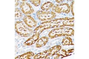Immunohistochemistry (IHC) image for anti-Ectonucleoside Triphosphate diphosphohydrolase 5 (ENTPD5) antibody (ABIN7266895)