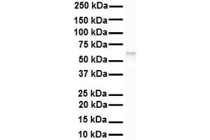 WB Suggested Anti-SNRP70 antibody Titration: 1 ug/mL Sample Type: Human Raji (SNRNP70 antibody  (N-Term))