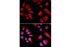Immunofluorescence analysis of U2OS cells using CBS antibody (ABIN5970665). (CBS antibody)
