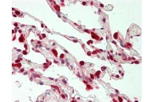 Human Lung: Formalin-Fixed, Paraffin-Embedded (FFPE) (LTA4H antibody)