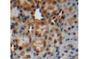 Used in DAB staining on fromalin fixed paraffin-embedded liver tissue (CYP24A1 antibody  (AA 37-250))