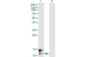 Western Blot analysis of BGLAP expression in transfected 293T cell line by BGLAP monoclonal antibody (M01), clone 2D4.