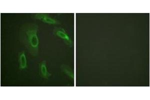 Immunofluorescence analysis of HeLa cells, using CD227/Mucin 1 (Ab-1243) Antibody. (MUC1 antibody  (AA 1204-1253))