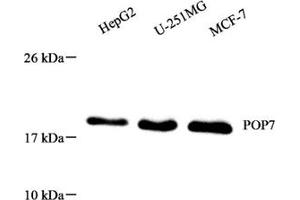 Western blot analysis of POP7 (ABIN7075179),at dilution of 1: 1000 (POP7 antibody)