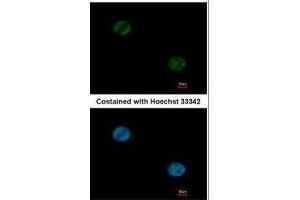 ICC/IF Image Immunofluorescence analysis of paraformaldehyde-fixed HeLa, using FOXA1, antibody at 1:1000 dilution. (FOXA1 antibody  (C-Term))