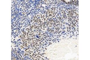 Immunohistochemistry analysis of paraffin-embedded mouse ovary using,FOXL2 (ABIN7073971) at dilution of 1: 6000 (FOXL2 antibody)