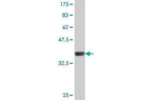 Western Blot detection against Immunogen (37. (GKAP1 antibody  (AA 151-250))