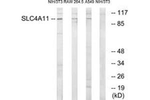 Western blot analysis of extracts from NIH-3T3/RAW264. (SLC4A11 antibody  (AA 291-340))