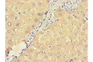 Immunohistochemistry of paraffin-embedded human liver tissue using ABIN7166376 at dilution of 1:100 (ZNF738 antibody  (AA 1-137))