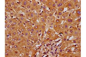 IHC image of ABIN7168014 diluted at 1:200 and staining in paraffin-embedded human liver tissue performed on a Leica BondTM system. (RND1 antibody  (AA 1-106))