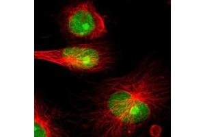 Immunofluorescence of U-251 MG cell line with IFI16 polyclonal antibody  shows positivity in nucleus and nucleoli. (IFI16 antibody)