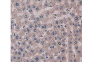 IHC-P analysis of Rat Tissue, with DAB staining. (MYH8 antibody  (AA 40-240))