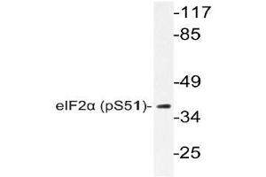 Western blot (WB) analyzes of p-eIF2alpha antibody in extracts from Jurkat insulin cells. (EIF2S1 antibody  (pSer51))