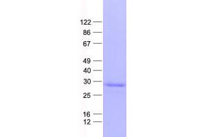 Validation with Western Blot (FOLR3 Protein (His tag))