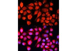 Immunofluorescence analysis of HeLa cells using MRPS28 Polyclonal Antibody (ABIN6133074, ABIN6144041, ABIN6144042 and ABIN6220731) at dilution of 1:100 (40x lens). (MRPS28 antibody  (AA 1-187))