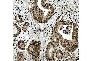 IHC analysis of SFPQ using anti-SFPQ antibody (ABIN7603089).