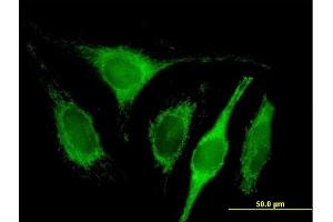 Immunofluorescence (IF) image for anti-Complement Component 1, Q Subcomponent Binding Protein (C1QBP) (AA 1-282) antibody (ABIN513842)