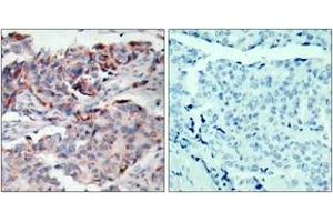 Immunohistochemistry (IHC) image for anti-Janus Kinase 2 (JAK2) (AA 191-240), (pTyr221) antibody (ABIN1531883)