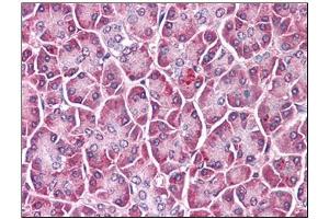 Human Pancreas: Formalin-Fixed, Paraffin-Embedded (FFPE) (GPC4 antibody  (C-Term))
