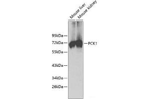 Western blot analysis of extracts of various cell lines using PCK1 Polyclonal Antibody. (PCK1 antibody)