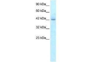 Human HepG2; WB Suggested Anti-RGS20 Antibody Titration: 5.