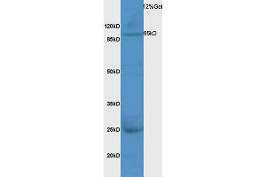 Rat liver lysates probed with Anti MPS1 Polyclonal Antibody, Unconjugated (ABIN873234) at 1:200 overnight at 4 °C. (Mps1 antibody  (AA 601-700))