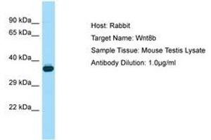 Image no. 1 for anti-Wingless-Type MMTV Integration Site Family, Member 8B (WNT8B) (AA 251-300) antibody (ABIN6749826)