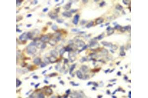 Immunohistochemistry of paraffin-embedded Human colon carcinoma using APLP1 Polyclonal Antibody at dilution of 1:100 (40x lens). (APLP1 antibody)
