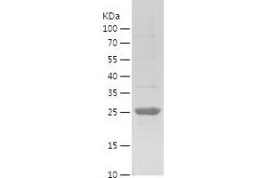 Western Blotting (WB) image for Excision Repair Cross Complementing Polypeptide-1 (ERCC1) (AA 1-200) protein (His tag) (ABIN7122858) (ERCC1 Protein (AA 1-200) (His tag))