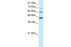 WB Suggested Anti-PRMT3 Antibody Titration:  0. (PRMT3 antibody  (Middle Region))