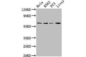 Western Blot Positive WB detected in: Hela whole cell lysate, K562 whole cell lysate, PC-3 whole cell lysate, Mouse liver tissue All lanes: RORA antibody at 2. (RORA antibody  (AA 110-214))